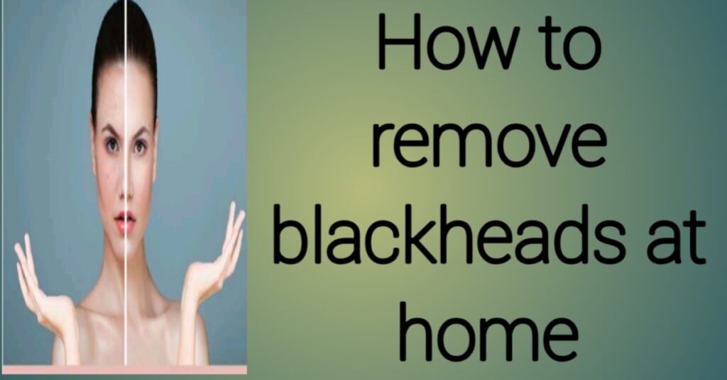 Remove blackheads